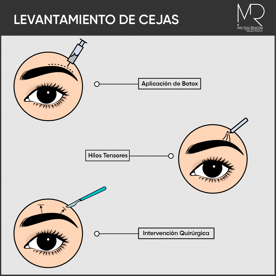 Evolución de abdominoplastia